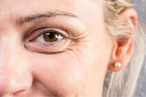 A close up of a middle aged woman's face focusing on the smile lines or crows feet around her eyes
