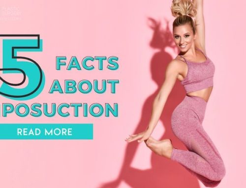 5 Common Facts About Liposuction