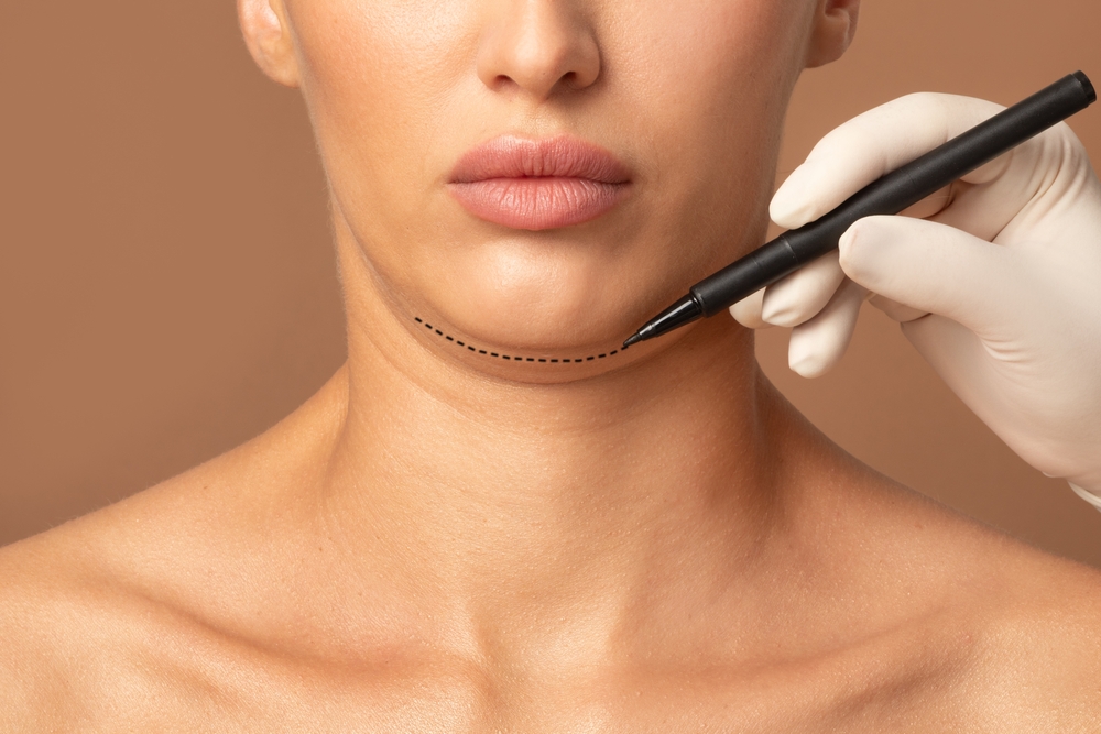 how to treat a double chin with kybella