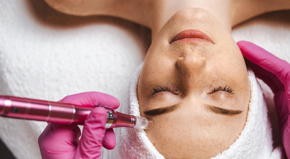 skin pen microneedlng in nashville