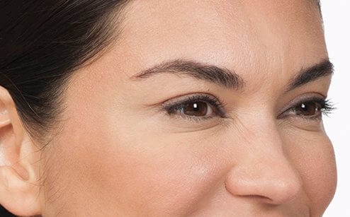 Middle-aged woman showing the results of wrinkle reduction treatments