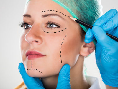 A plastic surgeon drawing the guiding lines on the face of a facelift surgery candidate.