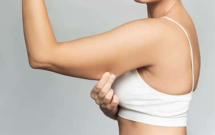 young woman in white tank top pinching her arm fat before arm liposuction at garza plastic surgery in nashville tennessee