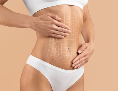 Full Tummy Tuck vs. Mini Tummy Tuck Surgery